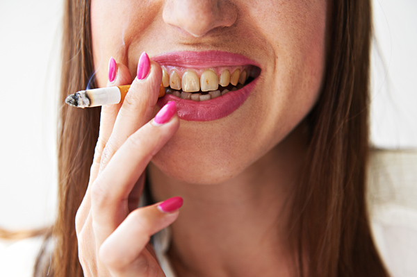 Hypnotherapist in Chester and Colwyn Bay close up of woman with pink lipstick pink nails and smoke stained teeth smoking a cigarette